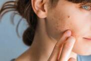 Erupção cutânea: Quais são as causas das erupções cutâneas (mesmo inflamadas, vermelhas e com comichão)?