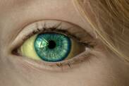 O que pode causar o branco dos olhos amarelo?